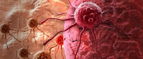 Cancer : 53.000 nouveaux cas recensés chaque année, selon le Pr Zitouni